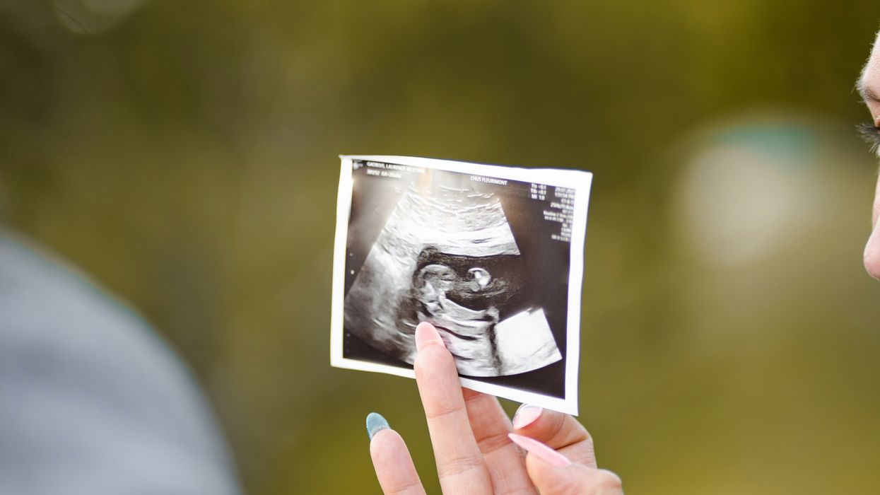 Homicide is Now the Top Killer of Pregnant Women in the U.S