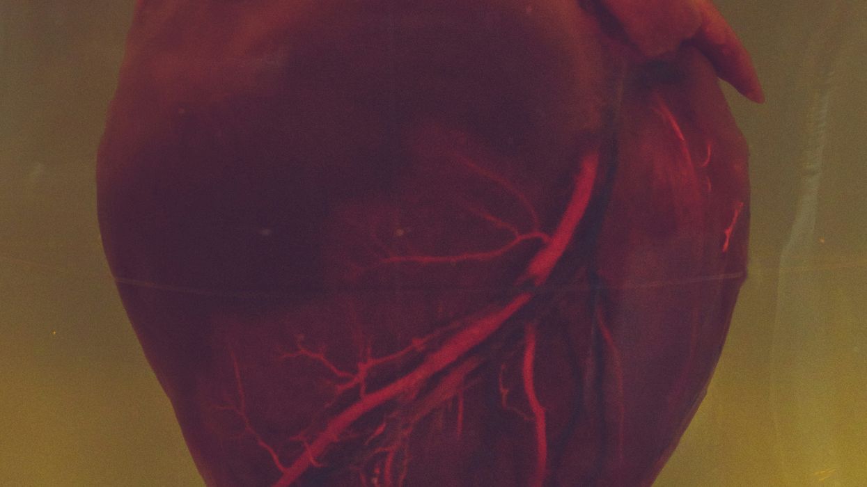 Unhealthy Habits Boost Heart Disease Risk in Low-Income Communities